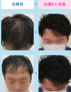 AGAスキンクリニックの症例画像