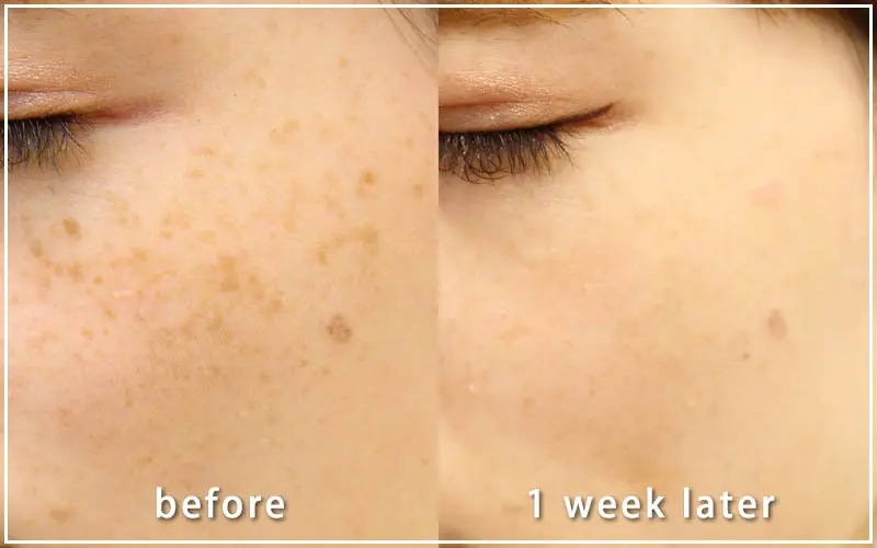 共立美容外科の症例画像