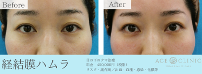 エースクリニックの症例画像