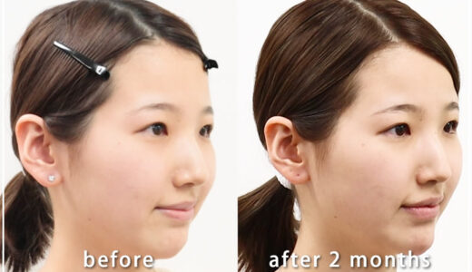 共立美容外科の症例画像