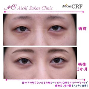 あいち栄クリニックの症例画像