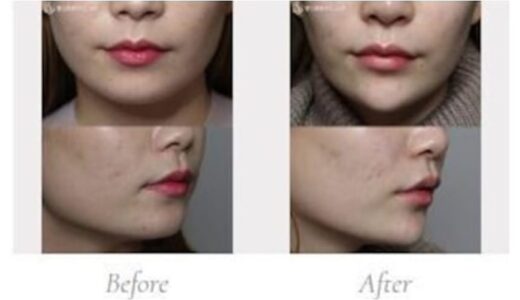 聖心美容クリニックの症例画像