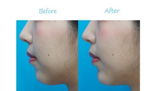 ガーデンクリニックの症例画像