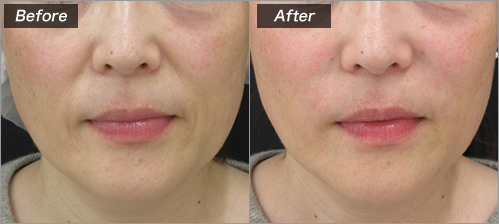 城本クリニックの症例画像