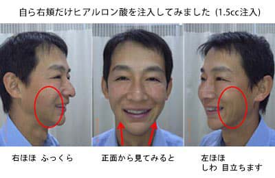 大西美容形成クリニックの症例画像