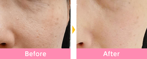 品川美容外科の症例画像