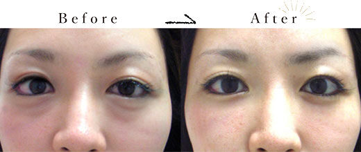 ウェルネスビューティクリニックの症例画像