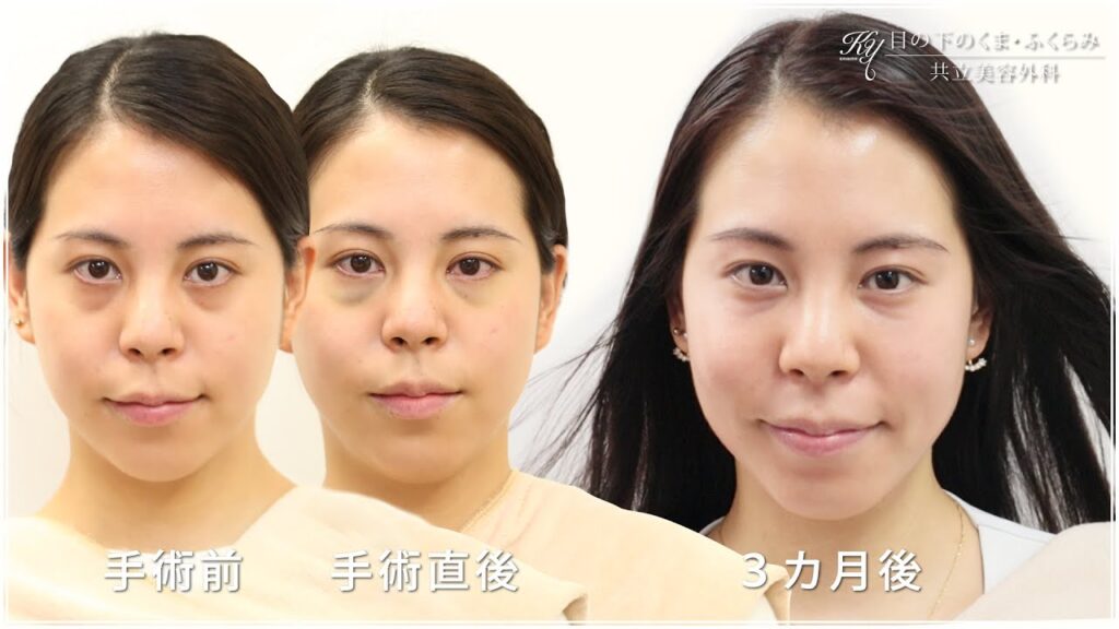 共立美容外科の症例画像