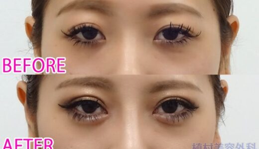 植村美容外科の症例画像