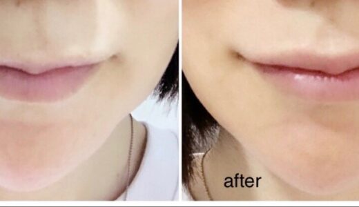 野本真由美スキンケアクリニックの症例画像