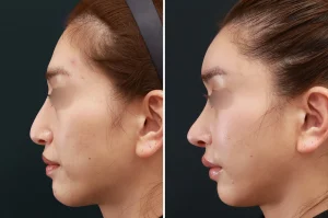 TAクリニックの症例画像