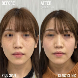 グランツクリニックの症例画像