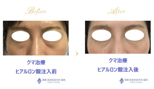 東郷美容形成外科の症例画像