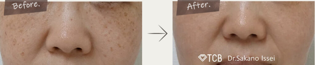 東京中央美容外科の症例画像