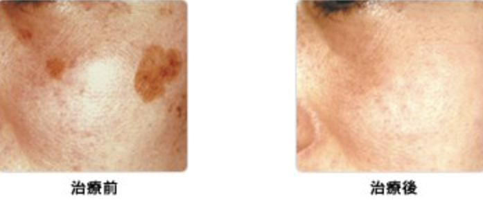 シロノクリニックの症例画像