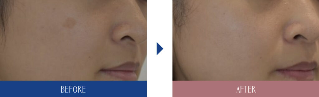 グレーススキンクリニックの症例画像