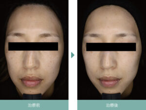 すなおクリニックの症例画像