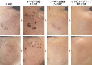 大西皮フ科形成外科医院の症例画像