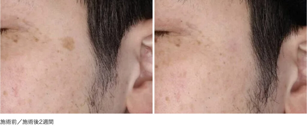 銀座よしえクリニックの症例画像