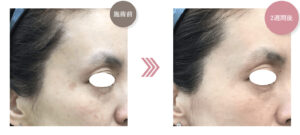 熊本かよこクリニックの症例画像