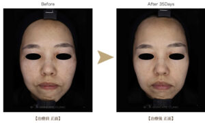 ワイズスキンケアクリニックの症例画像