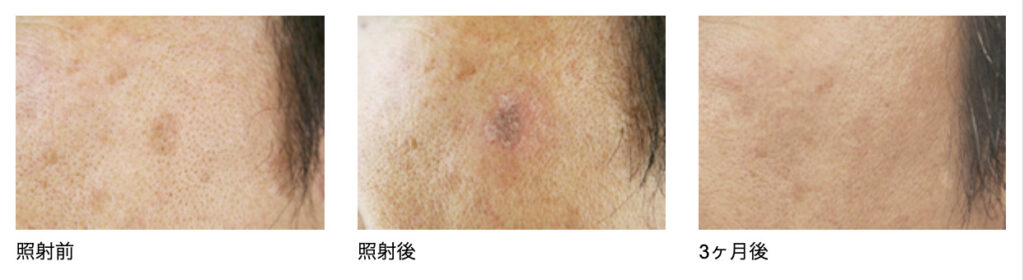 広島プルミエクリニックの症例画像