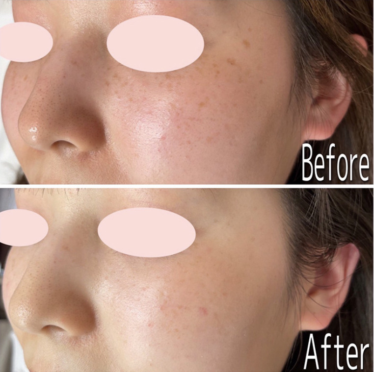 札幌クララ美容外科の症例画像