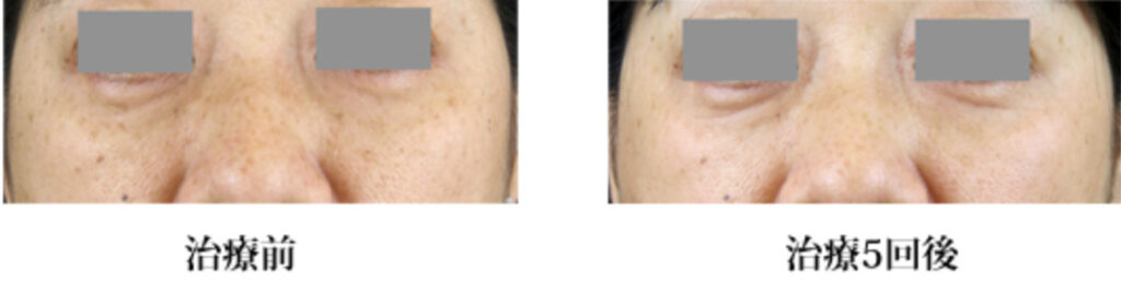 神戸ゆりクリニックの症例画像