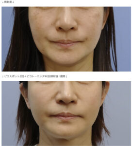 CLASSY仙台美容外科・美容皮膚科の症例画像