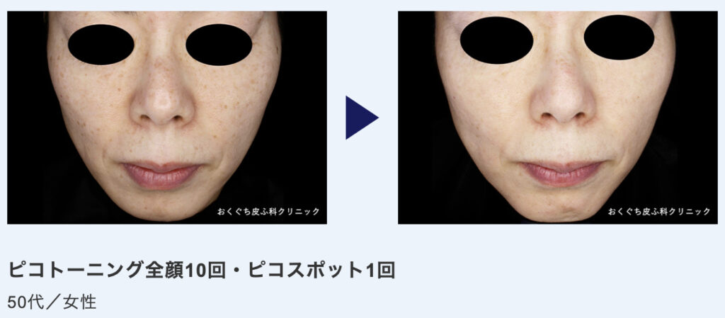 おくぐち皮ふ科の症例画像