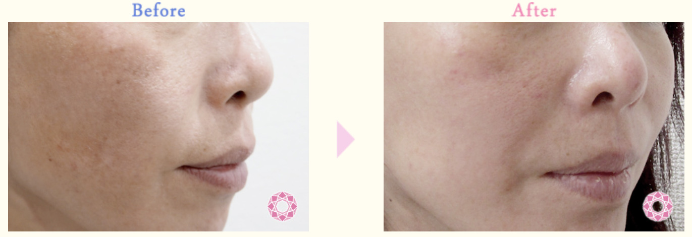 東京形成美容外科の紹介画像