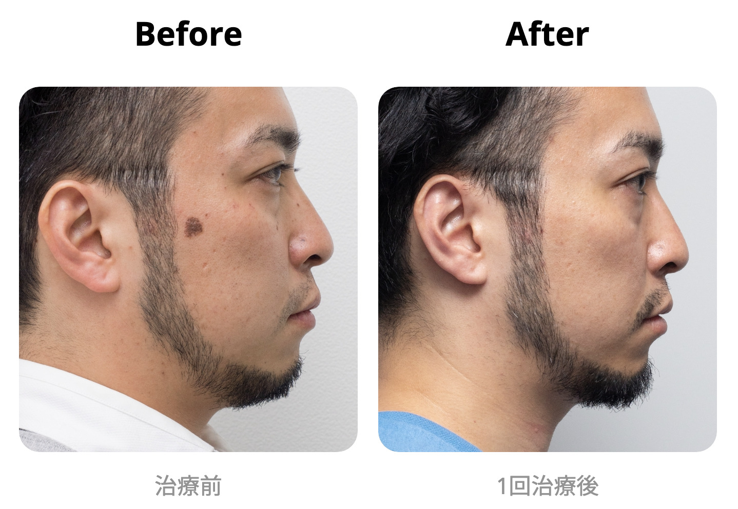 ゴリラクリニックの症例画像