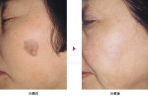 船橋中央クリニックの症例画像