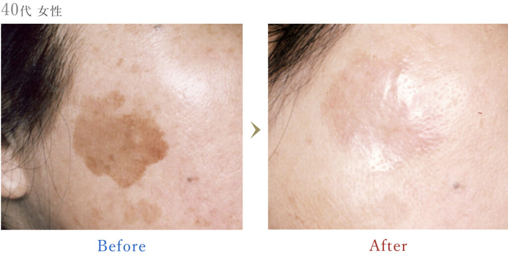 藤沢美容クリニックの症例画像