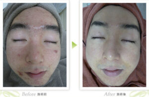 城本クリニックの症例画像