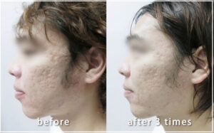 共立美容外科の症例画像