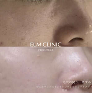 エルムクリニックの症例画像