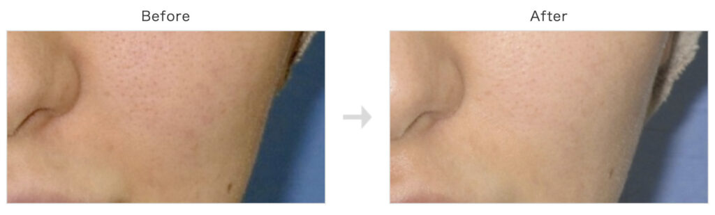 トキコクリニックの症例画像