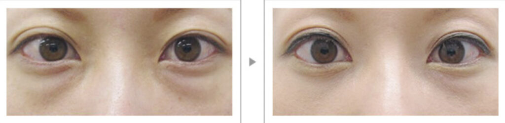 品川スキンクリニックの症例画像