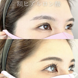 東京中央美容外科の症例画像