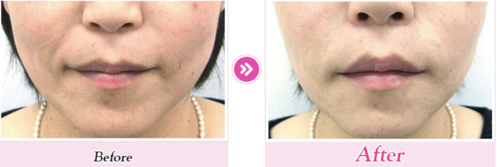 品川スキンクリニックの症例画像