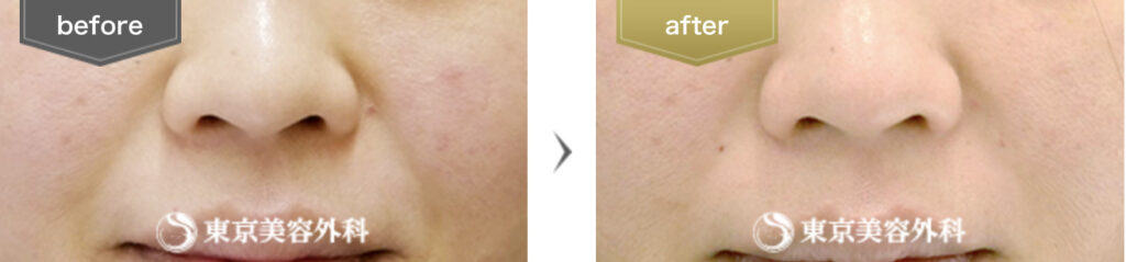 東京美容外科の症例画像