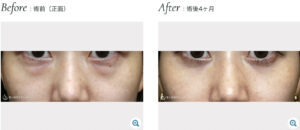 聖心美容クリニックの症例画像