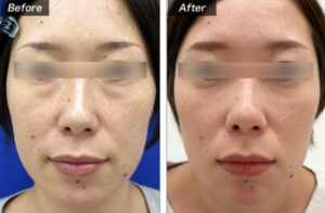 城本クリニックの症例画像