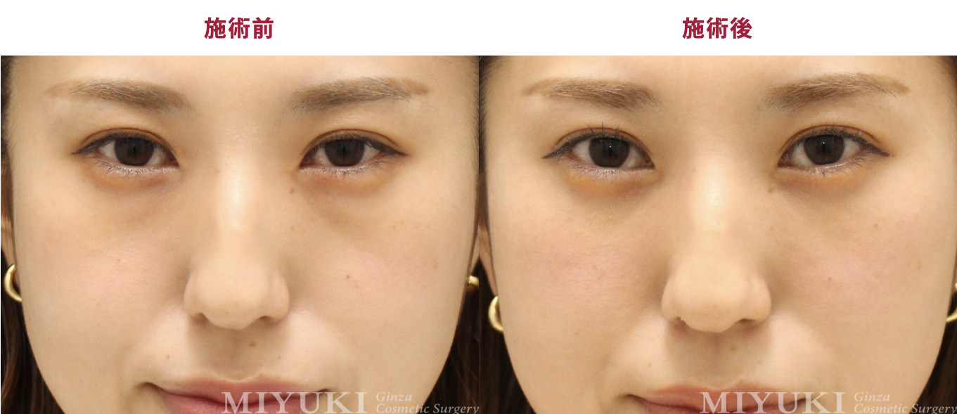 銀座みゆき通り美容外科の症例画像