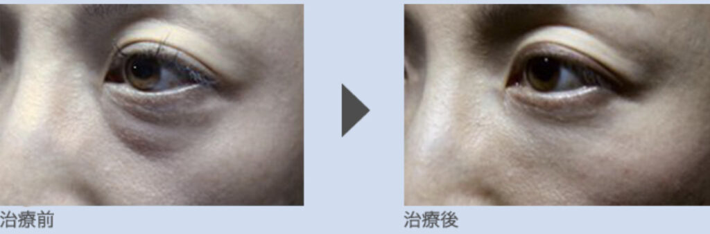 美容皮膚科タカミクリニックの症例画像