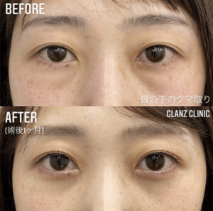 グランツクリニックの症例画像