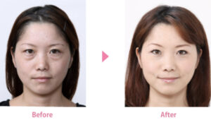 宇都宮竹内クリニックの症例画像