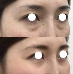 ステラ美容クリニックの症例画像