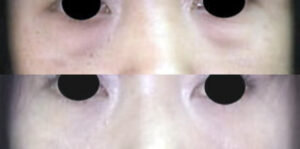 宮崎美容外科クリニックの症例画像